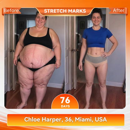 𝐂𝐥𝐞𝐚𝐫𝐞𝐧𝐚® 𝟐𝟎𝟐𝟔 𝐌𝐨𝐫𝐢𝐧𝐠𝐚 x 𝐁𝐞𝐫𝐛𝐞𝐫𝐢𝐧𝐞 x 𝐍𝐀𝐃+ 𝟔-𝐈𝐧-𝟏 𝐌𝐢𝐜𝐫𝐨-𝐏𝐚𝐫𝐭𝐢𝐜𝐥𝐞 𝐒𝐜𝐮𝐥𝐩𝐭𝐢𝐧𝐠 & 𝐅𝐚𝐭-𝐁𝐮𝐫𝐧 𝐒𝐡𝐨𝐫𝐭𝐬 (Women + Men with Enhanced Male Vitality Blend)